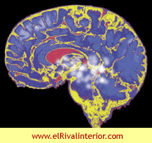 Efectos de la Presión Psicológica en el Funcionamiento Cerebral 
